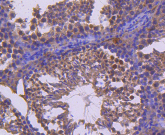 Anti-RET Antibody (8T974)