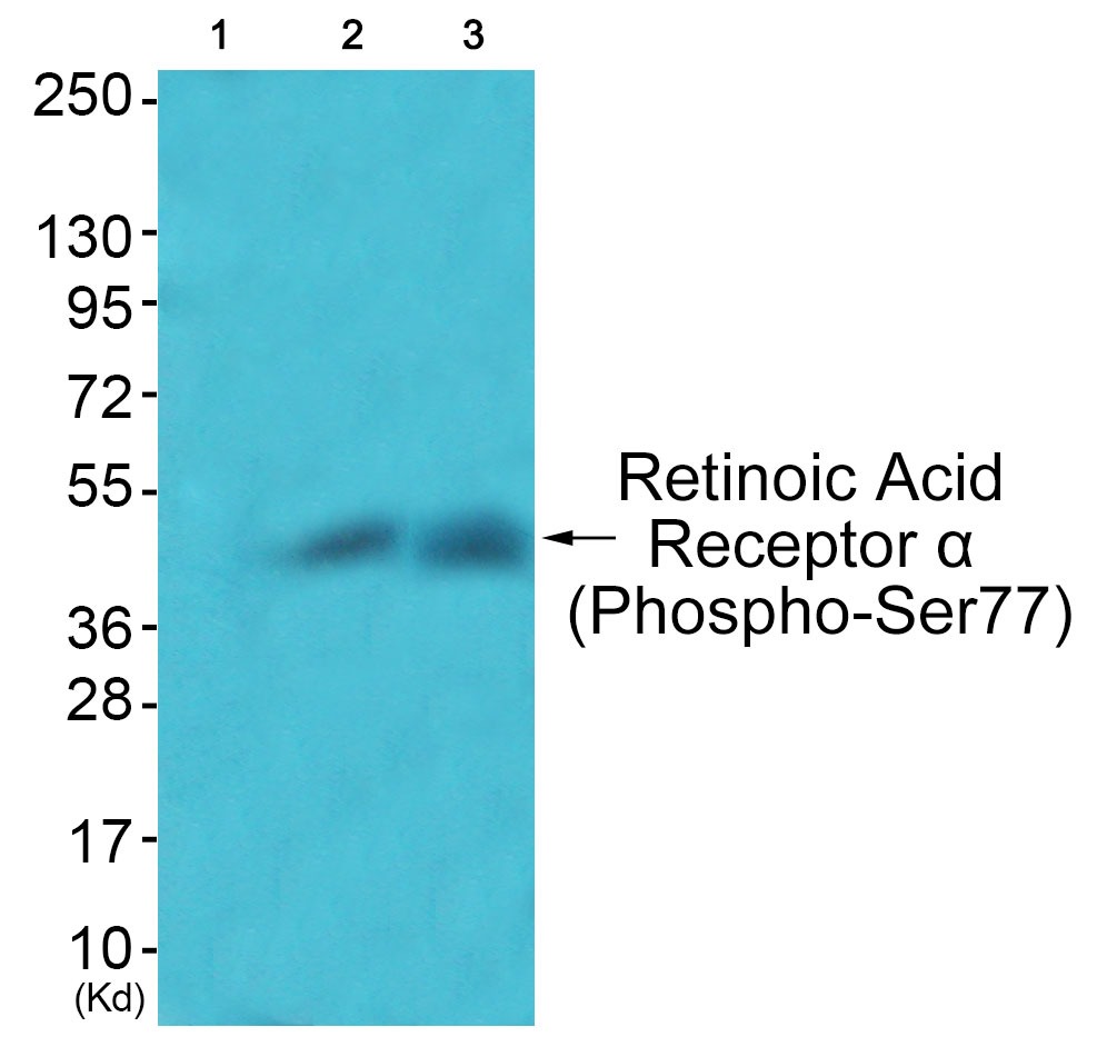 Anti-Phospho-RARA (Ser77) Polyclonal Antibody