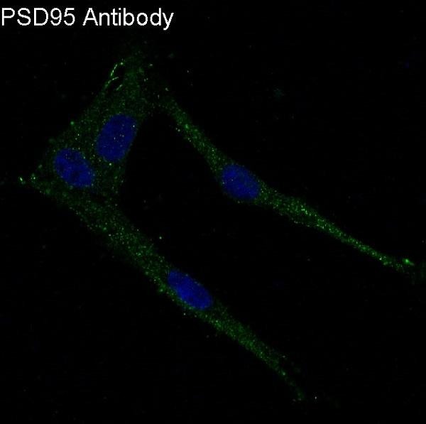 Anti-DLG4 Antibody (7K534)