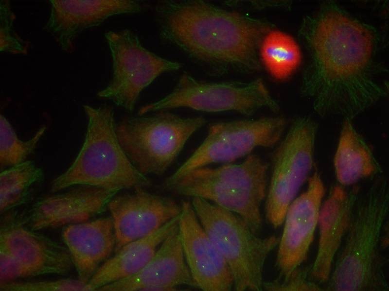 Anti-Phospho-PTEN (Ser380, Thr382, 383) Polyclonal Antibody