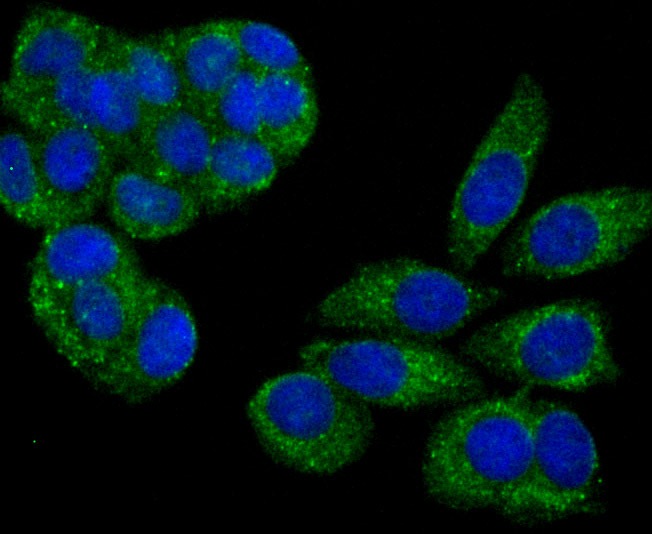 Anti-PSME1 Antibody (8P627)