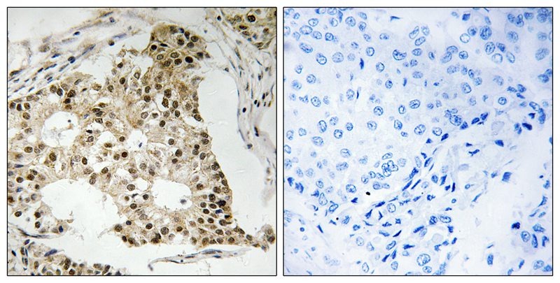 Anti-Phospho-RARA (Ser77) Polyclonal Antibody
