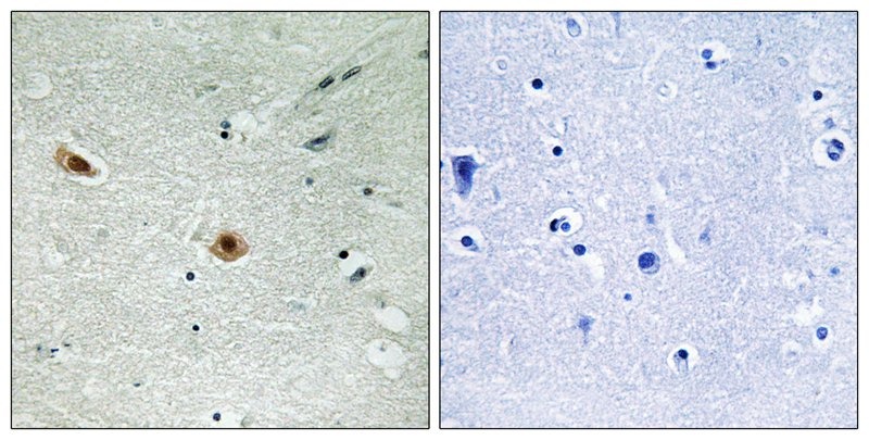 Anti-Phospho-RB1 (Ser608) Polyclonal Antibody