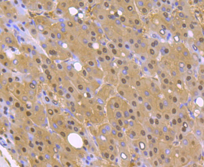 Anti-PSMA1 Antibody (8C777)