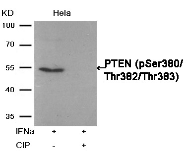 Anti-Phospho-PTEN (Ser380, Thr382, 383) Polyclonal Antibody