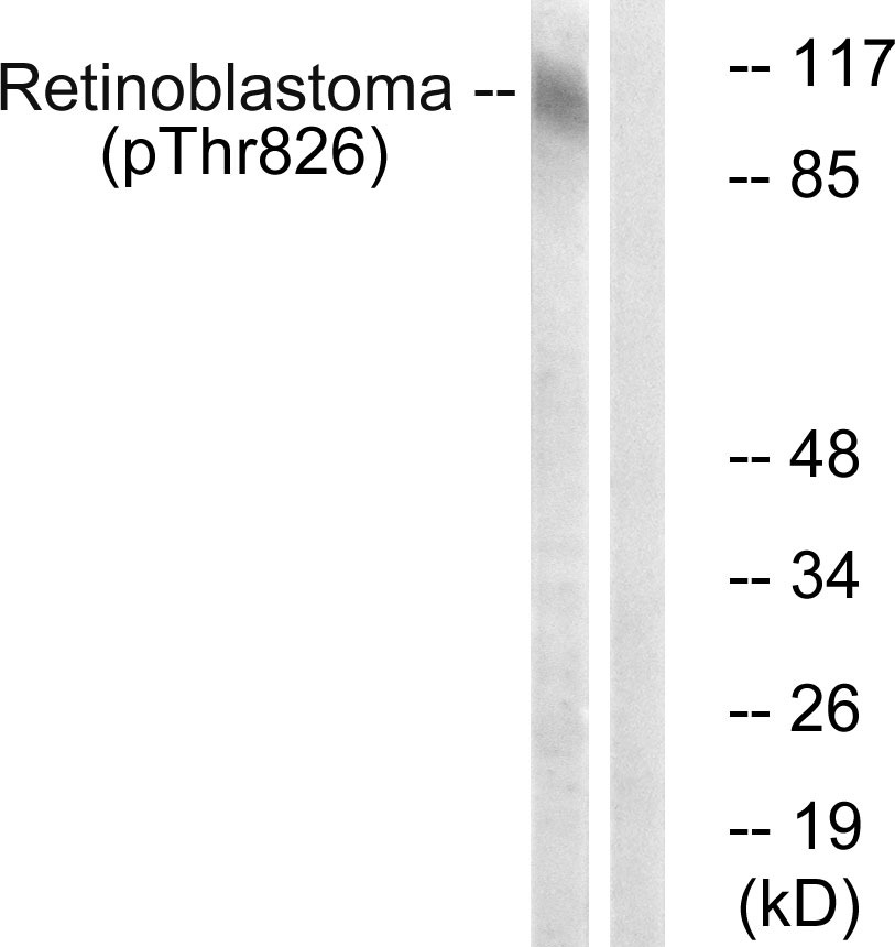 Anti-Phospho-RB1 (Thr826) Polyclonal Antibody