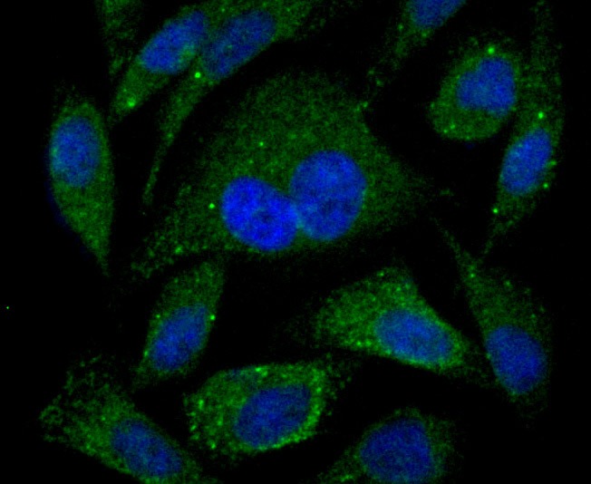 Anti-PSME1 Antibody (8P627)