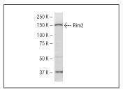 Anti-RIM 2 Antibody (5F972)