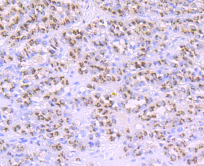 Anti-PSME1 Antibody (8P627)