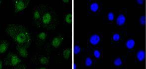 Anti-RELB Antibody (7J786)