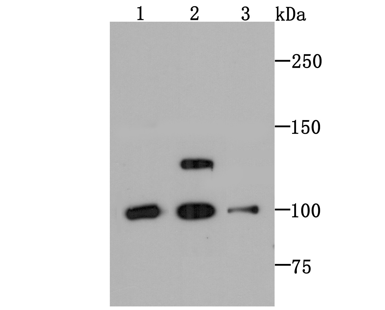 Anti-PSD93 Antibody (5I700)