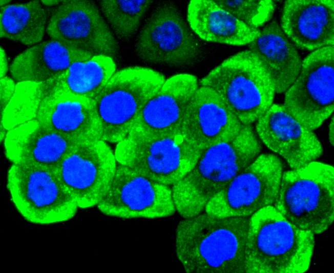 Anti-RET Antibody (8T974)