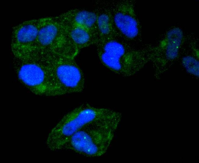 Anti-Radixin Antibody (3A6)