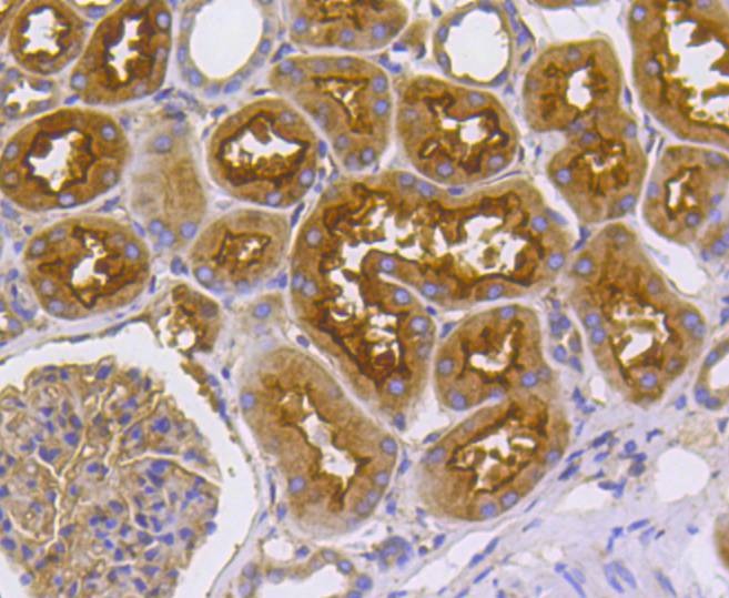 Anti-Radixin Antibody (3A6)