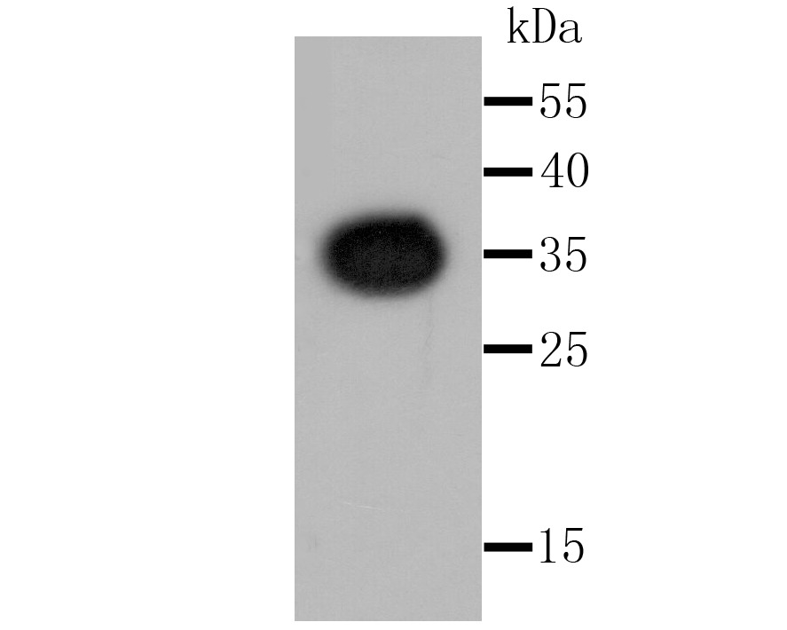 Anti-Renilla-type luciferase Antibody (8H856)
