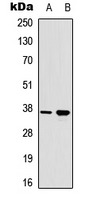 Anti-Phospho-RAD51 (Tyr315) Polyclonal Antibody