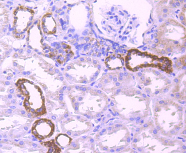 Anti-PDHB Antibody (9C498)