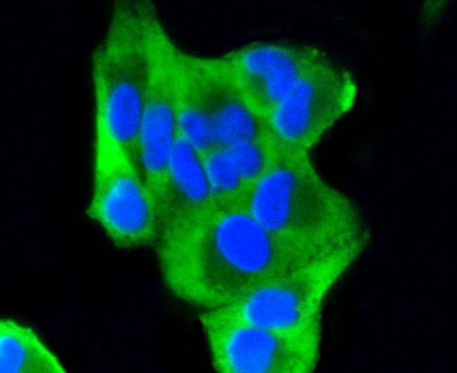 Anti-PUMA Antibody (5V529)