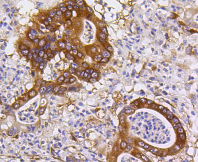 Anti-PUMA Antibody (5V529)