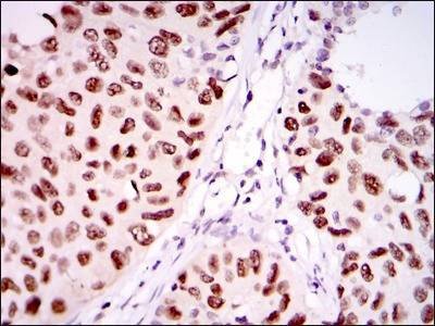 Anti-PSIP1 Antibody (7I174)