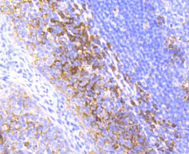 Anti-Radixin Antibody (3A6)