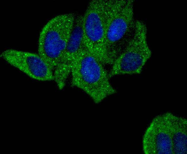 Anti-PYK2 Antibody (5I30)