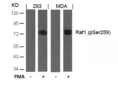 Anti-Phospho-RAF1 (Ser259) Polyclonal Antibody