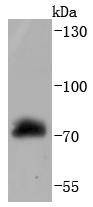 Anti-RAF1 Antibody (1T539)