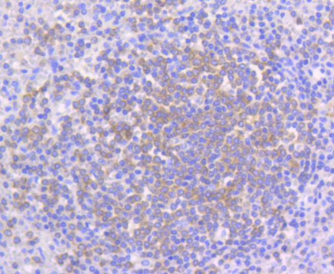 Anti-PYK2 Antibody (5I30)