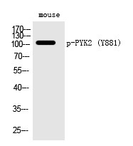 Anti-Phospho-PYK2 (Tyr881) Polyclonal Antibody