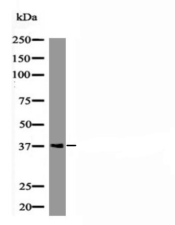 Anti-Phospho-RAD51 (Tyr54) Polyclonal Antibody