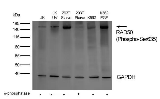 Anti-Phospho-RAD50 (Ser635) Polyclonal Antibody