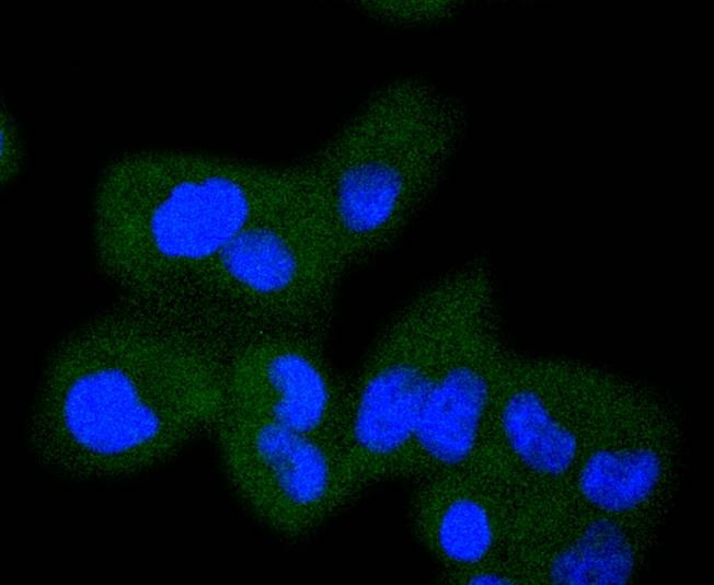 Anti-RAF1 Antibody (1T539)