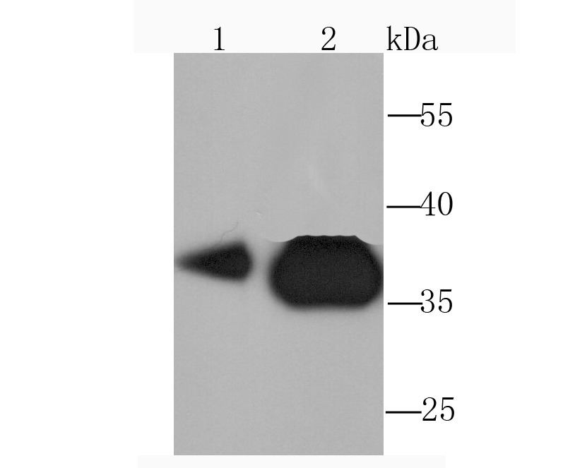 Anti-PDHB Antibody (9C498)