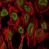 Anti-PSIP1 Antibody (7I174)