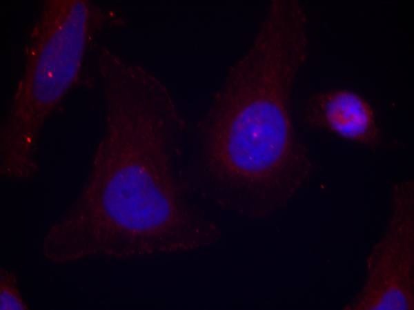 Anti-Phospho-PYK2 (Tyr402) Polyclonal Antibody