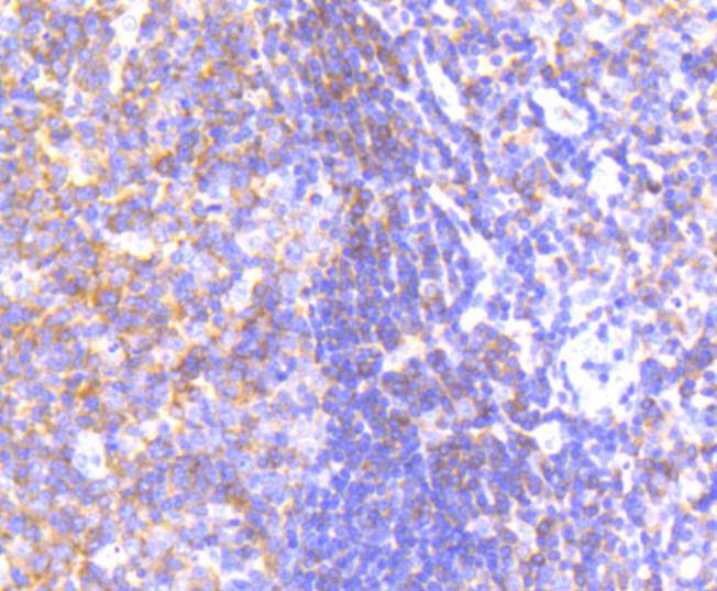 Anti-PYK2 Antibody (5I30)