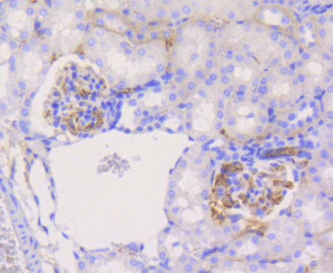 Anti-PYK2 Antibody (5I30)