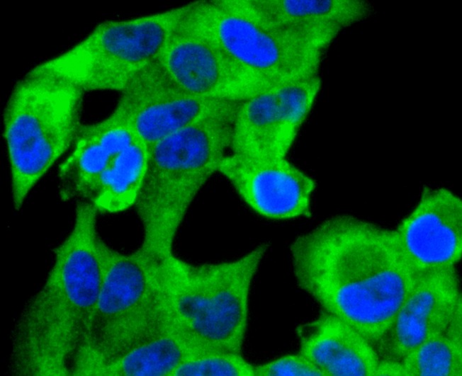 Anti-RAD18 Antibody (5U394)