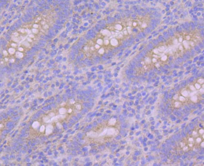 Anti-Pumilio 1 Antibody (3G125)