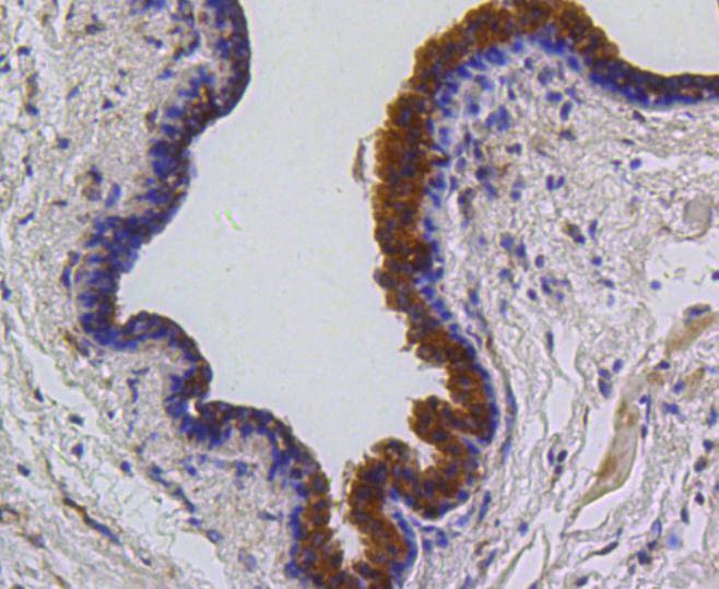 Anti-PUMA Antibody (5V529)