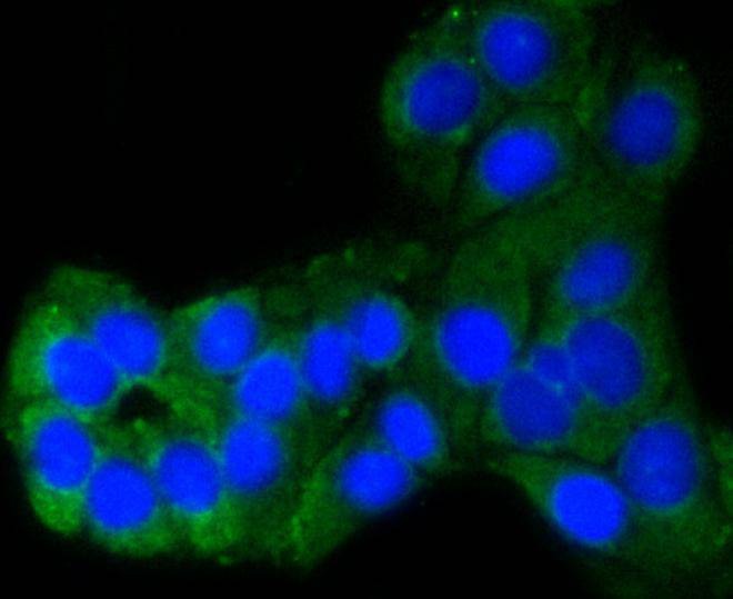 Anti-PUMA Antibody (5V529)