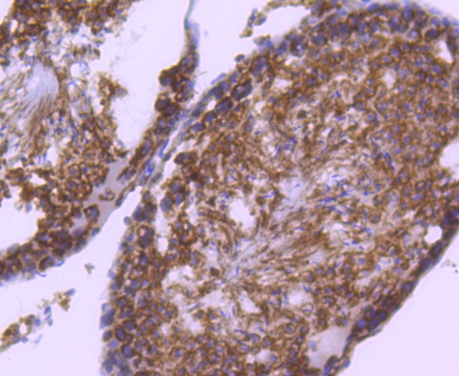 Anti-RAD18 Antibody (5U394)