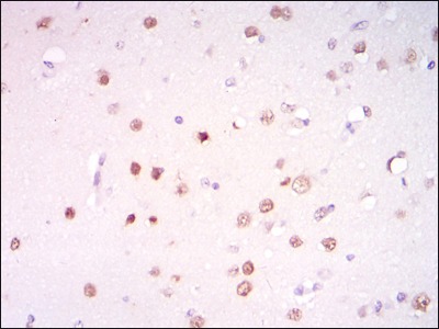 Anti-PSIP1 Antibody (7I174)