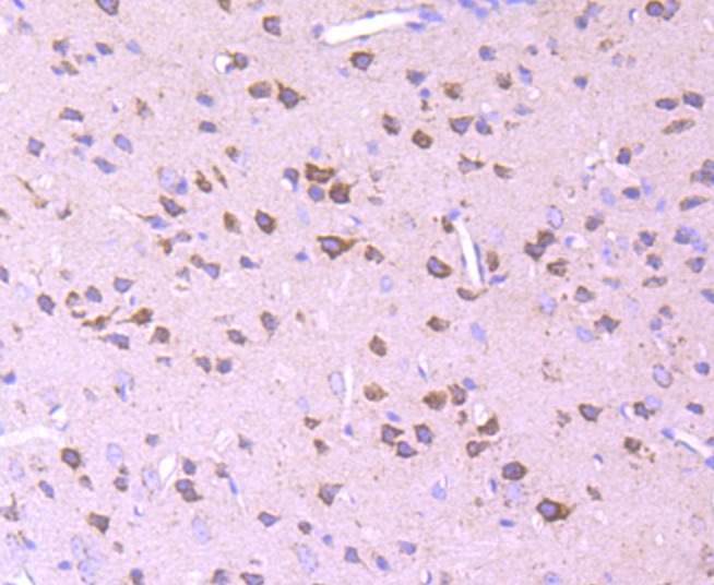 Anti-PDHB Antibody (9C498)