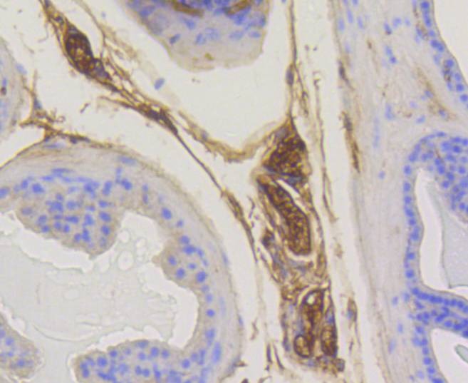 Anti-RAB5A Antibody (6H506)