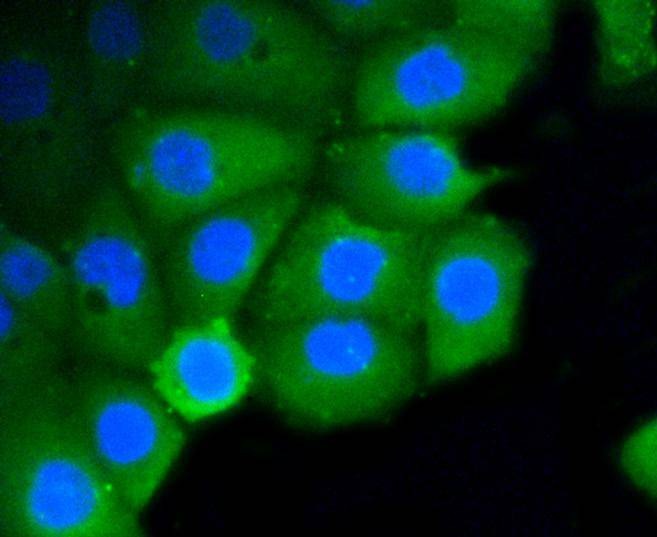 Anti-RhoA/B/C Antibody (1S695)