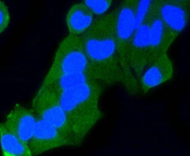 Anti-Rab9 Antibody (9V943)