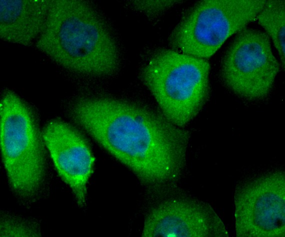 Anti-RheB Antibody (8S39)