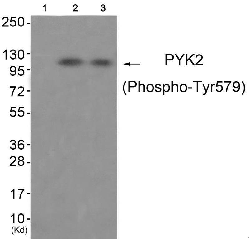 Anti-Phospho-PYK2 (Tyr579) Polyclonal Antibody